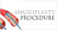 Angioplasty - Vanda Rossen